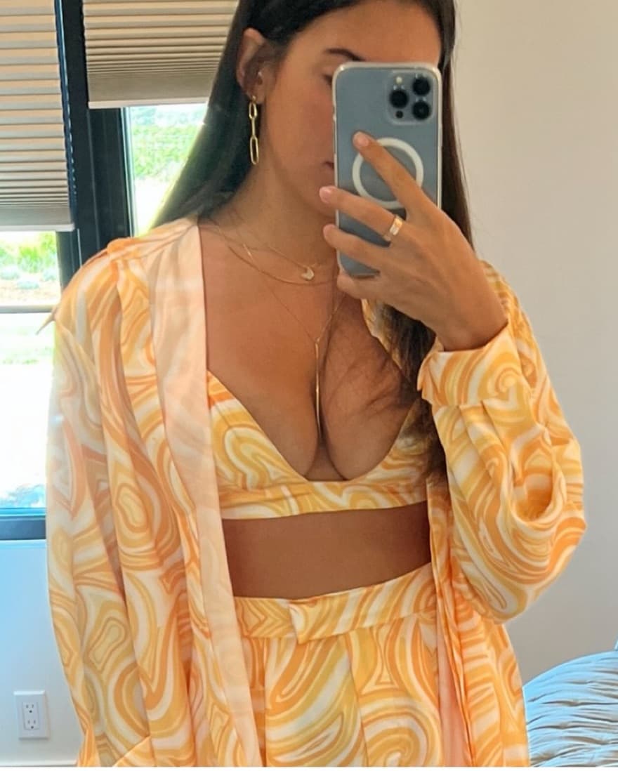 Ronny Kobo 3 Piece Set - Image 4