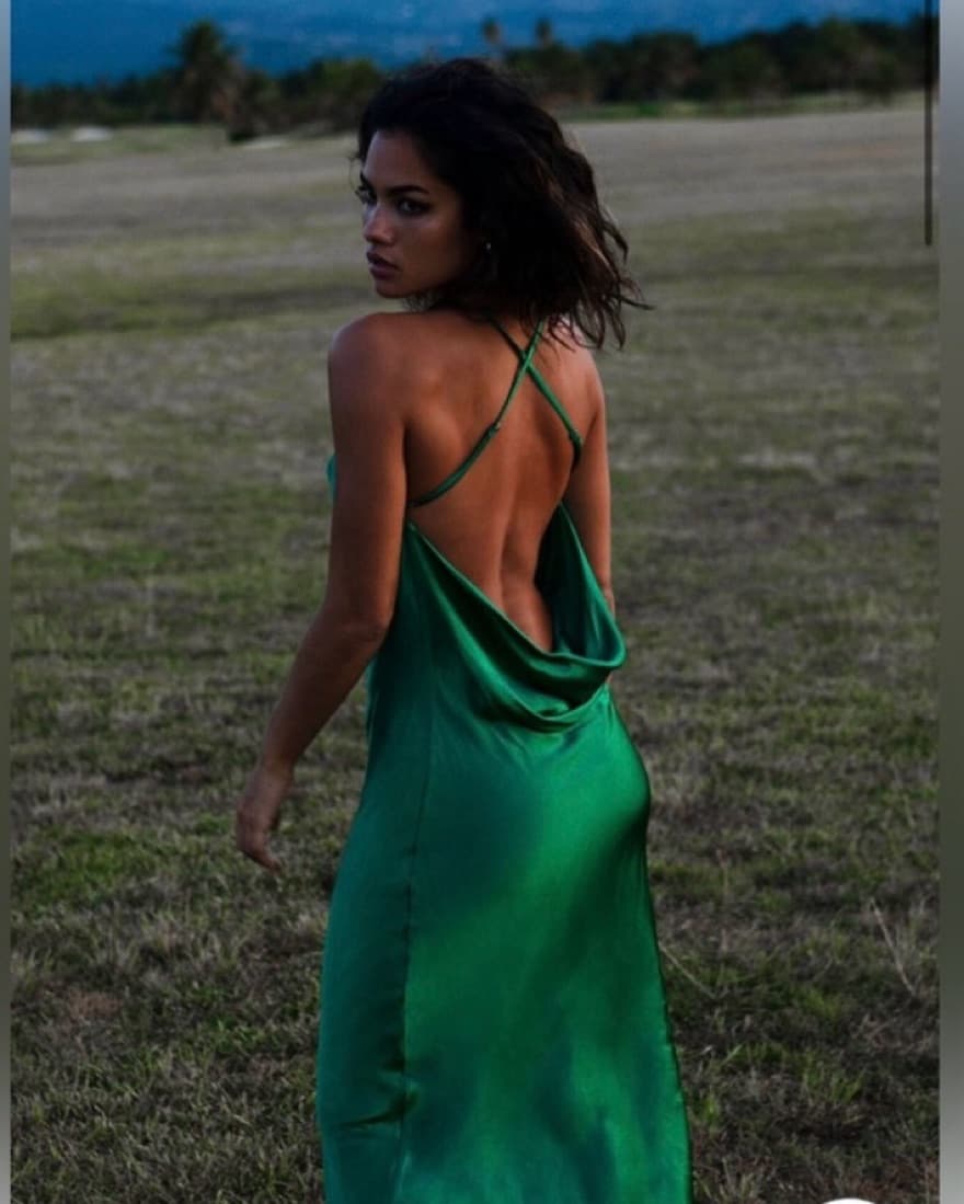 Rat & Boa Gigi Dress - Image 1