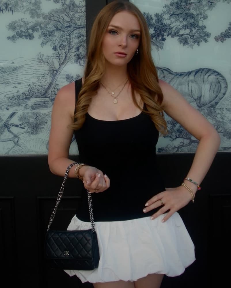 Edikted Black and White Mini Dress - Image 3