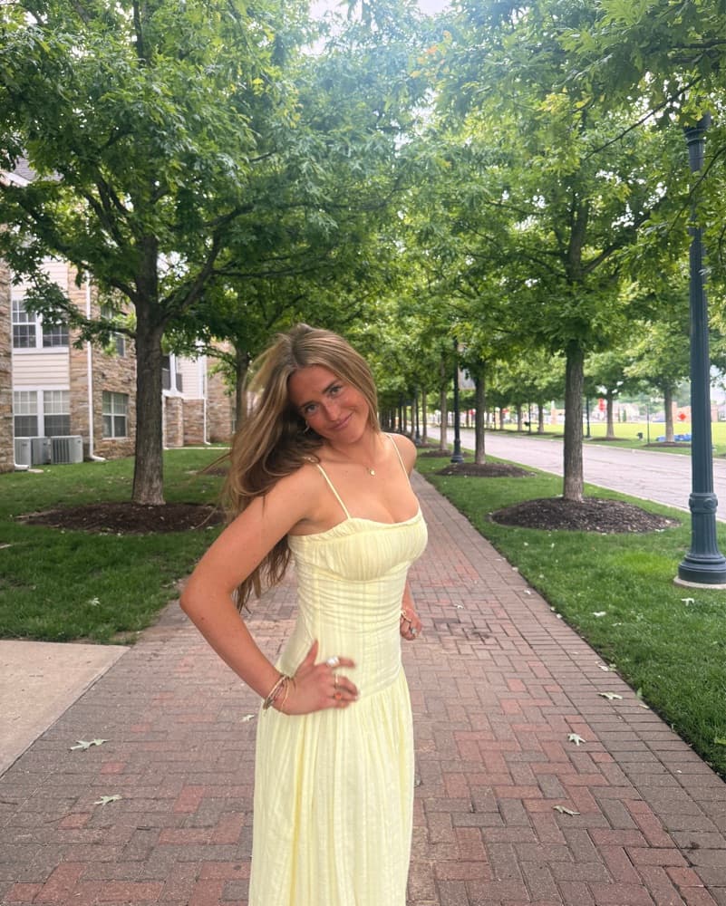 Yellow Dress  - Image 4