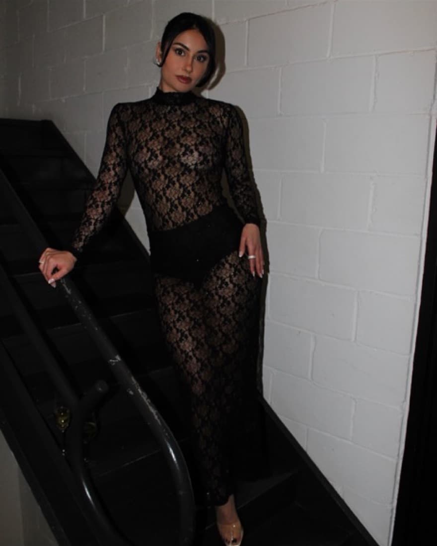 Lace Noughts And Kisses Dress - Image 2