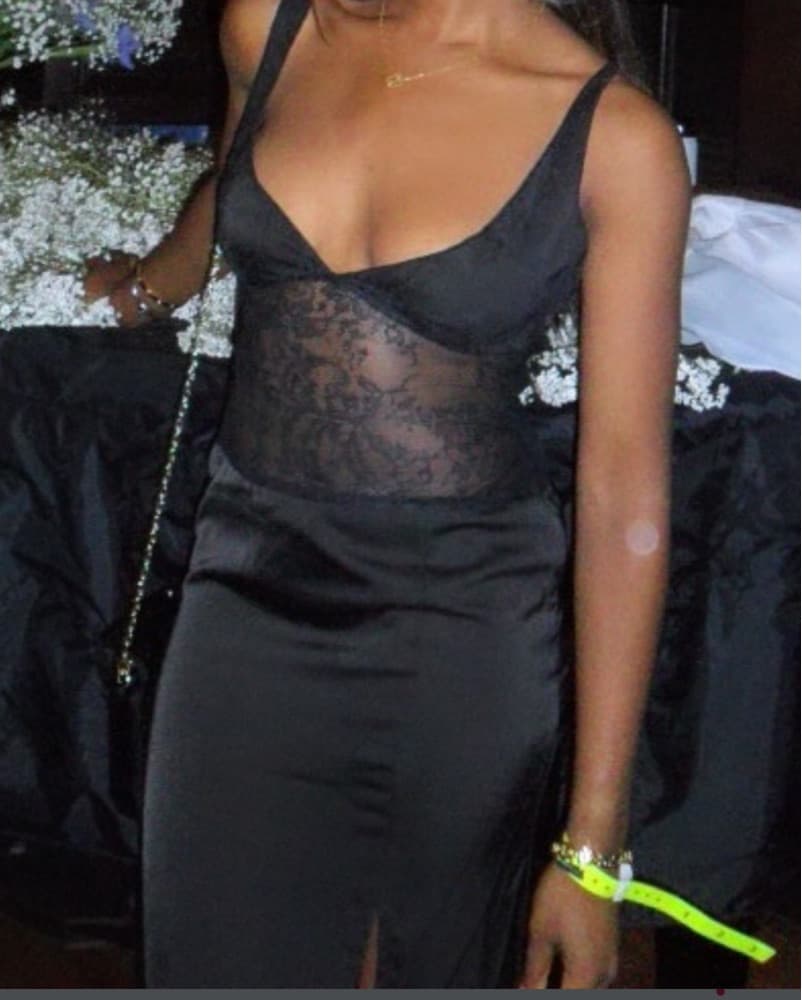 Backless Lace Dress  - Image 1