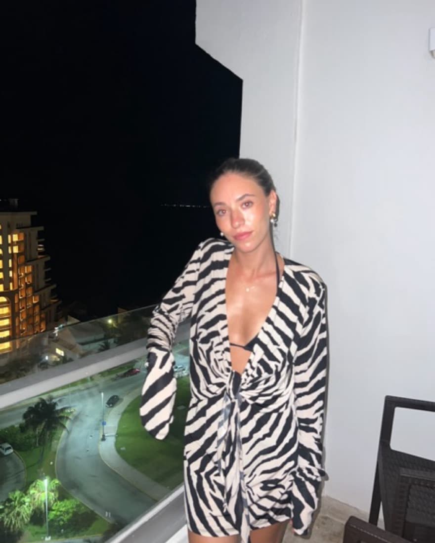 Zebra Tie Front Dress - Image 5