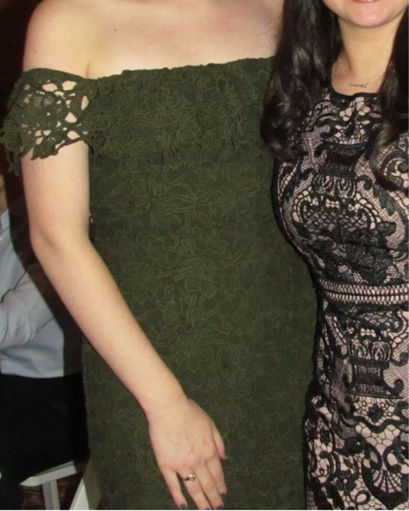 Chic Emerald Green Lace Midi Dress - Image 2