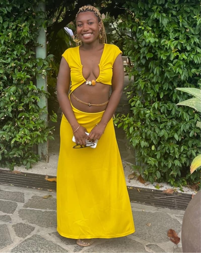 Vibrant Yellow Asymmetrical Dress - Image 2