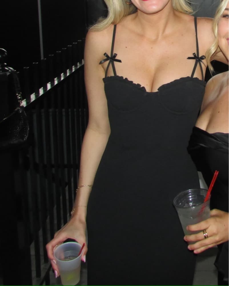 Staud Georgina Dress - Image 2
