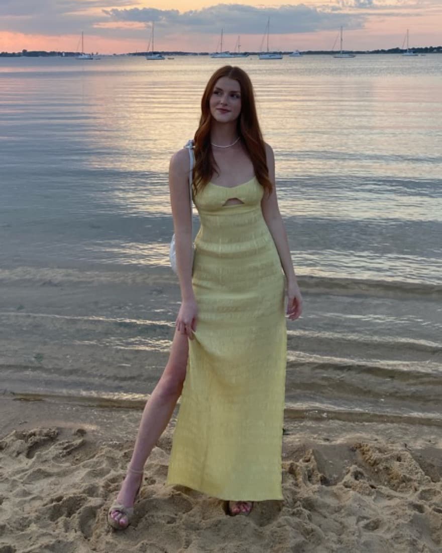 LPA Camille Dress Revolve - Image 3