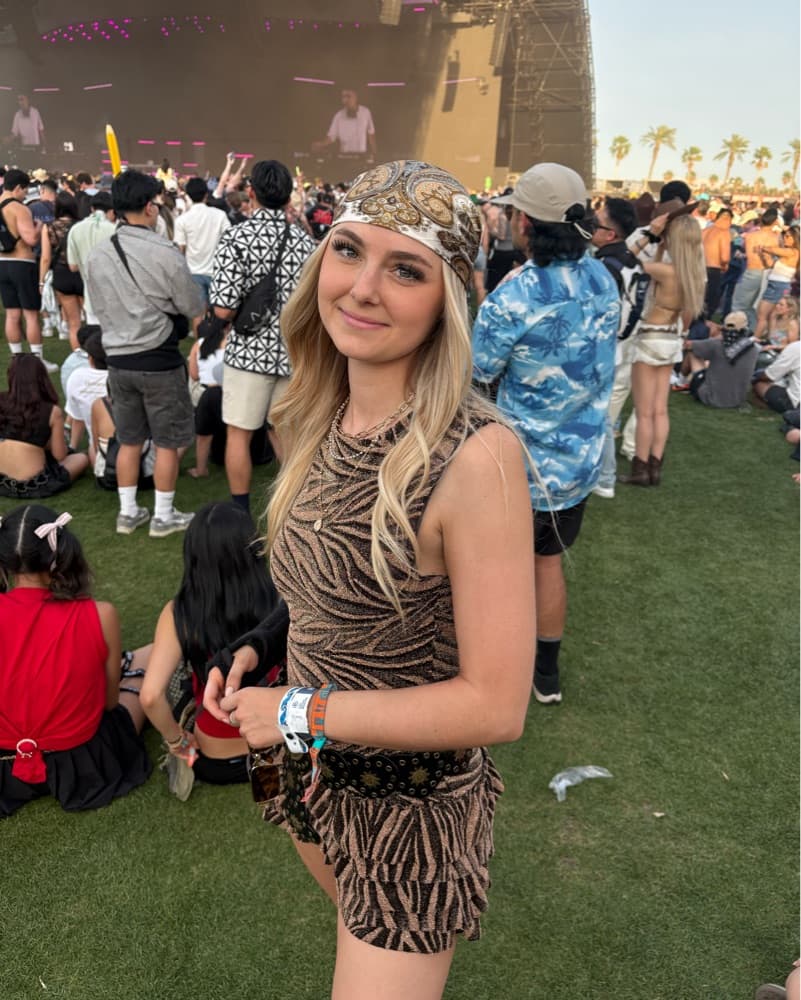 Zebra Romper - Image 1
