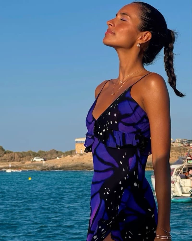Rat & Boa Beatriz Butterfly Dress - Image 2