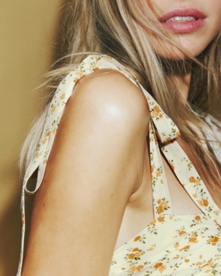 Reformation Avani Dress - Image 3
