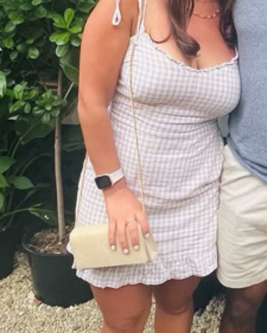 Abercrombie Dress - Image 1