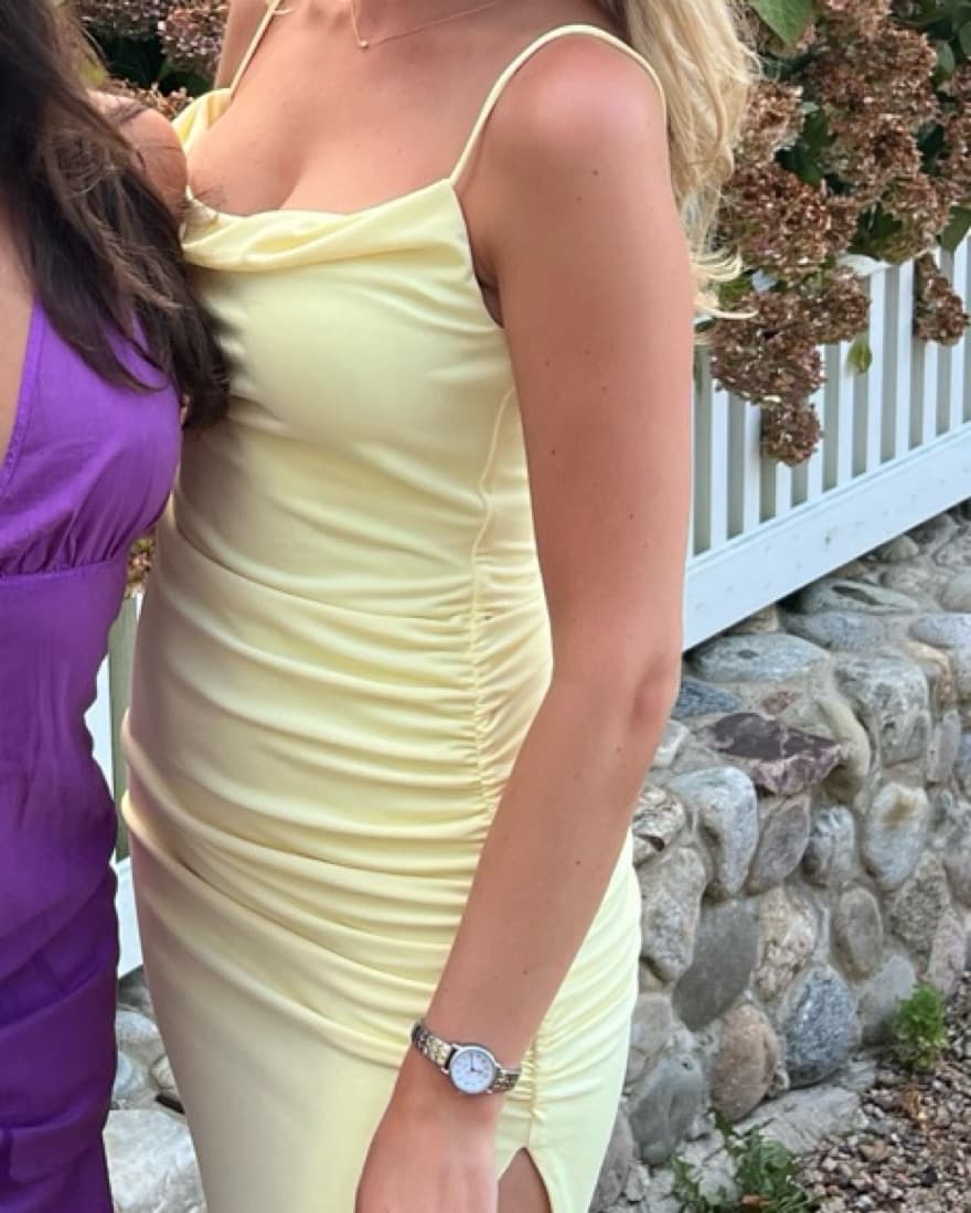 Lovers and Friends Dress - Image 4