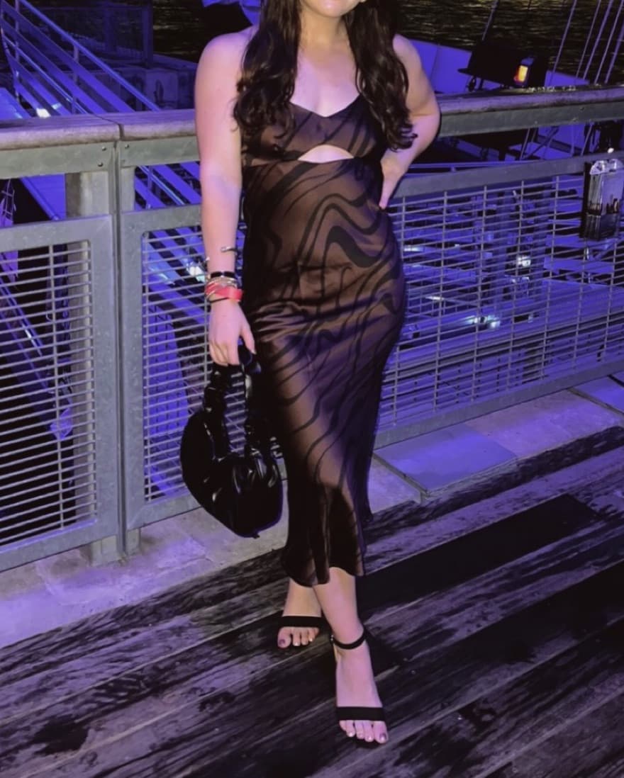 House Of Harlow Zebra Print Dress - Image 1