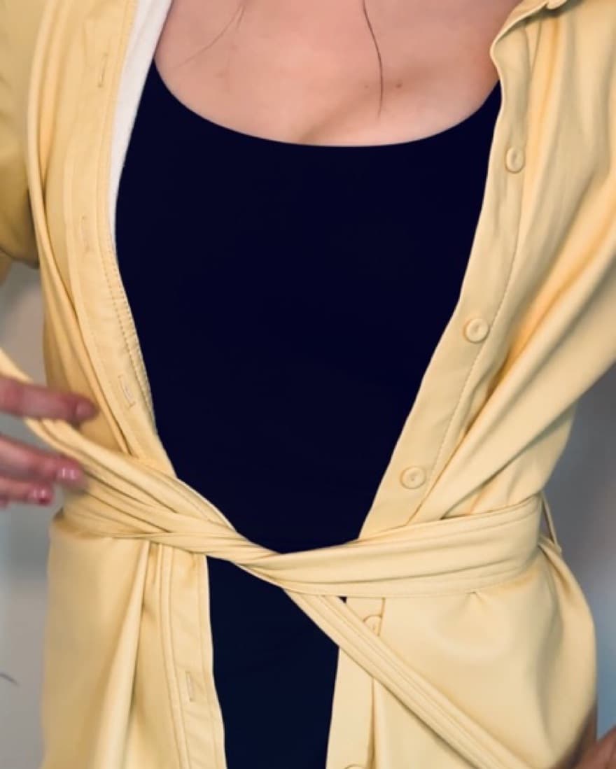 Yellow Aritzia Faux Leather Dress - Image 1