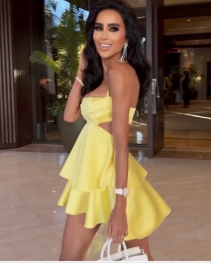 Yellow Zara Mini Dress - Image 3