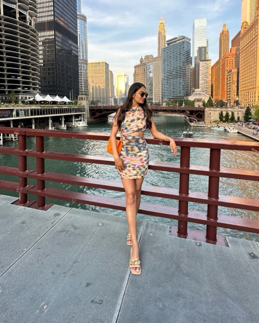 Zara Tie Dye Cut Out Dress  - Image 2