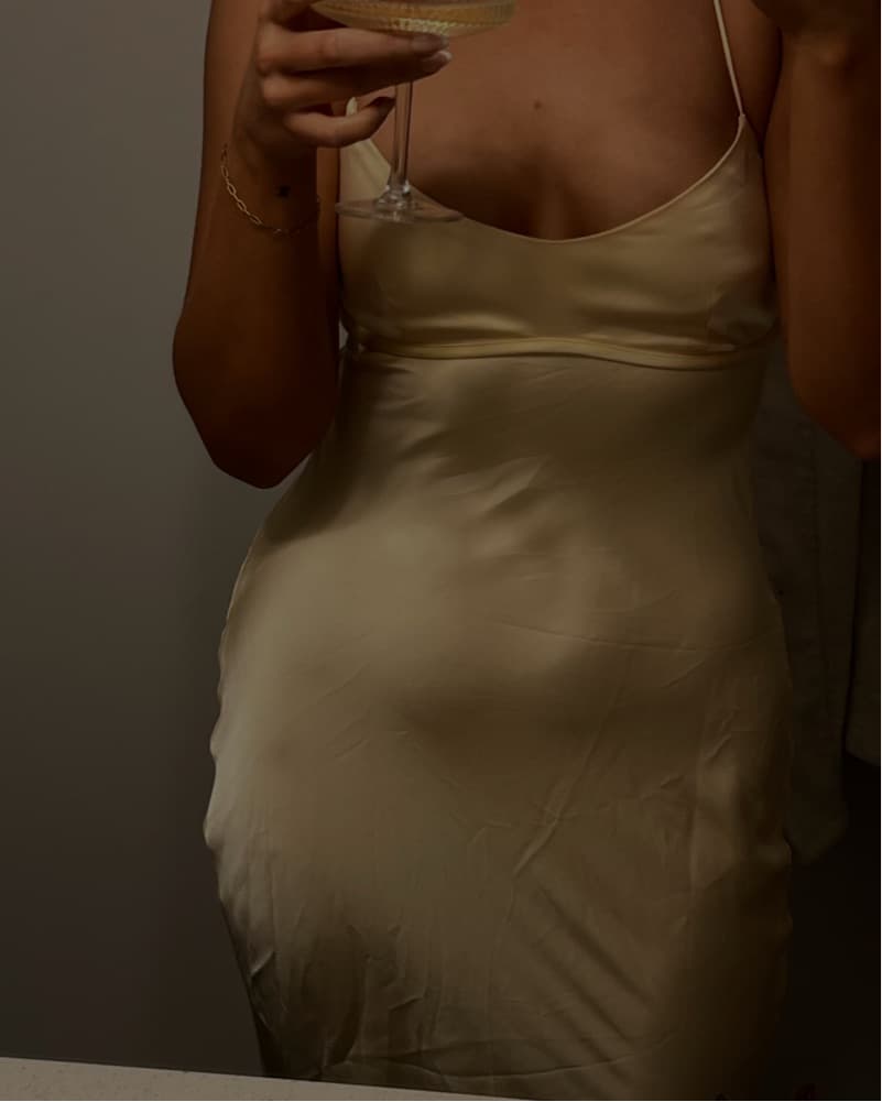 White fox yellow Dress - Image 2